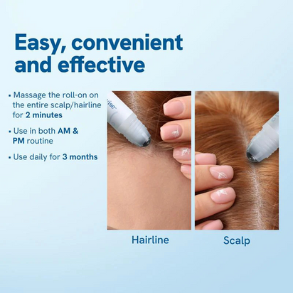 Hair Growth Serum Roller (25ml)