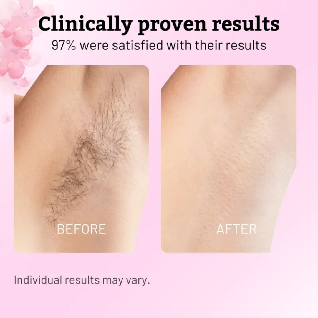 Cyperus Rotundus Oil for Natural Permanent Hair Reduction