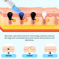 Blue Light Therapy Pen